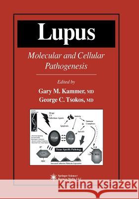 Lupus: Molecular and Cellular Pathogenesis Kammer, Gary M. 9781475756869 Humana Press - książka