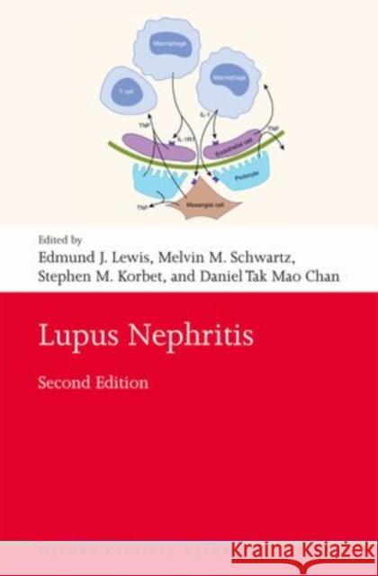 Lupus Nephritis Edmund J. Lewis Melvin M. Schwartz Stephen M. Korbet 9780199568055 Oxford University Press, USA - książka