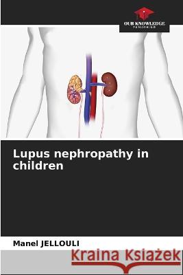 Lupus nephropathy in children Manel Jellouli 9786205870846 Our Knowledge Publishing - książka