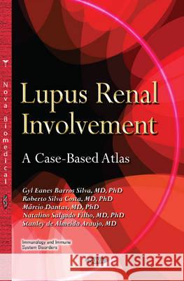 Lupus Renal Involvement: A Case-Based Atlas Gyl Eanes Barros Silva, Roberto Silva Costa, Márcio Dantas, Natalino salgado Filho, Stanley de Almeida Araujo 9781634638340 Nova Science Publishers Inc - książka