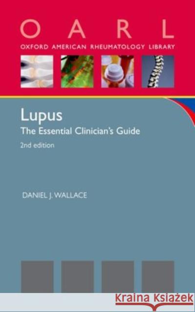 Lupus: The Essential Clinician's Guide (Revised) Wallace, Daniel J. 9780199361960 Oxford University Press, USA - książka