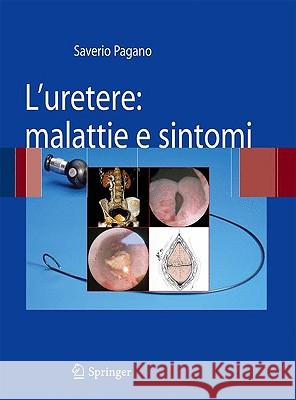 L'Uretere: Malattie E Sintomi Pagano, Saverio 9788847015203 Springer - książka