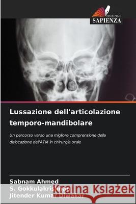 Lussazione dell'articolazione temporo-mandibolare Sabnam Ahmed S. Gokkulakrishnan Jitender Kumar Diwakar 9786207621057 Edizioni Sapienza - książka