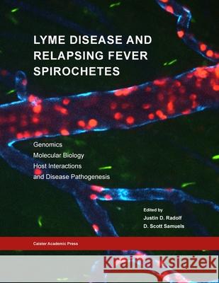 Lyme Disease and Relapsing Fever Spirochetes: Genomics, Molecular Biology, Host Interactions and Disease Pathogenesis Justin D. Radolf D. Scott Samuels 9781913652616 Caister Academic Press Limited - książka
