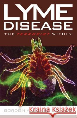 Lyme Disease: The Terrorist Within Gordon Gilkes 9781439201541 Booksurge Publishing - książka