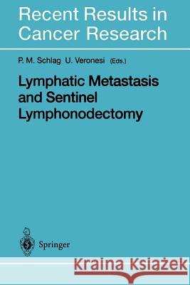 Lymphatic Metastasis and Sentinel Lymphonodectomy P. M. Schlag Umberto Veronesi 9783642630705 Springer - książka