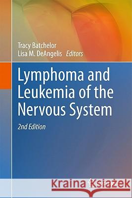 Lymphoma and Leukemia of the Nervous System Tracy Batchelor 9781441976673 Not Avail - książka