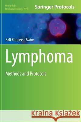 Lymphoma: Methods and Protocols Küppers, Ralf 9781627032681 Humana Press - książka