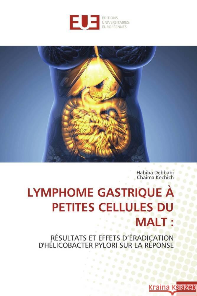 LYMPHOME GASTRIQUE À PETITES CELLULES DU MALT : Debbabi, Habiba, Kechich, Chaima 9786206726029 Éditions universitaires européennes - książka
