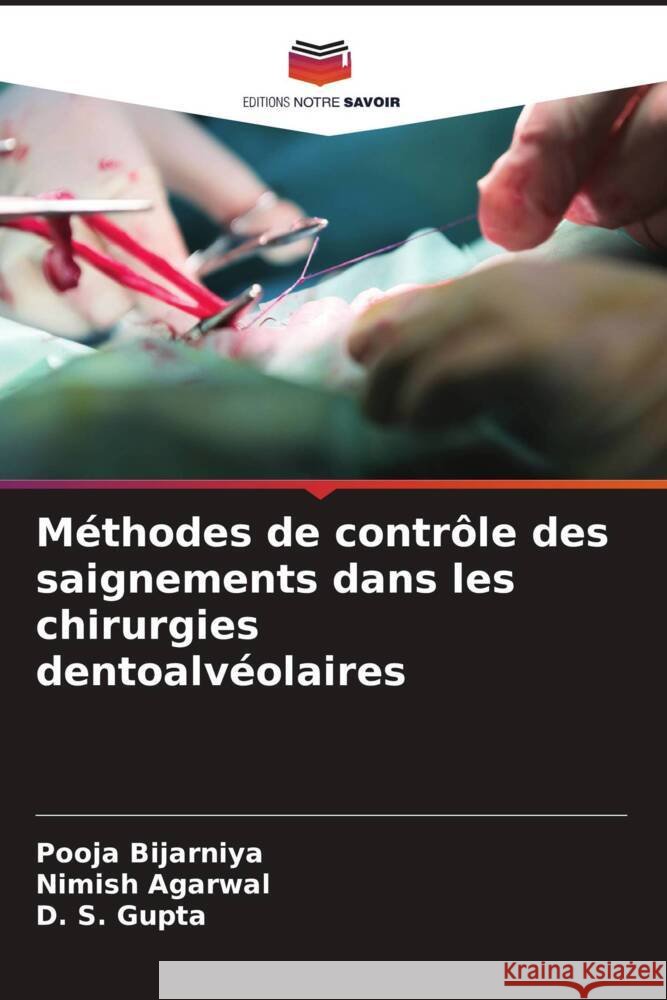 M?thodes de contr?le des saignements dans les chirurgies dentoalv?olaires Pooja Bijarniya Nimish Agarwal D. S. Gupta 9786207490219 Editions Notre Savoir - książka