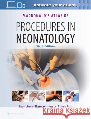 MacDonald's Atlas of Procedures in Neonatology  9781496394255 Lippincott Williams and Wilkins - książka