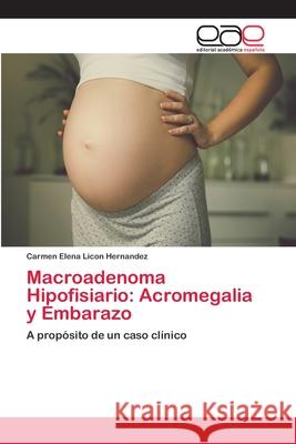 Macroadenoma Hipofisiario: Acromegalia y Embarazo Licon Hernandez, Carmen Elena 9786202148979 Editorial Académica Española - książka