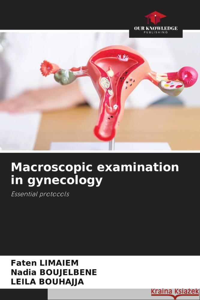 Macroscopic examination in gynecology Limaiem, Faten, BOUJELBENE, Nadia, BOUHAJJA, Leila 9786203694901 Our Knowledge Publishing - książka