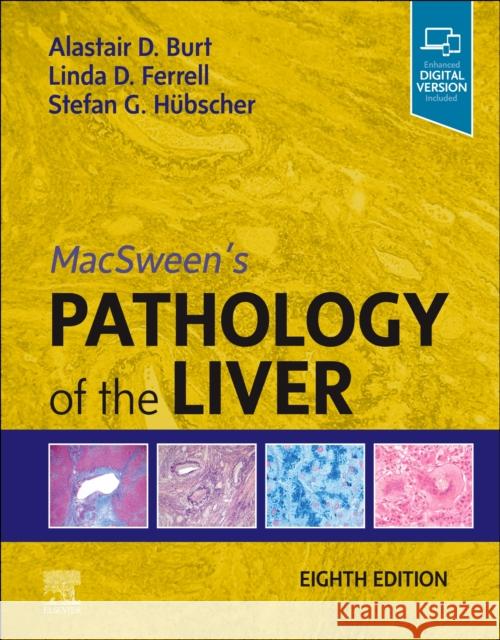 Macsween's Pathology of the Liver Burt, Alastair D. 9780702082283 Elsevier Health Sciences - książka