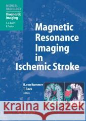 Magnetic Resonance Imaging in Ischemic Stroke K. Sartor 9783642056543 Not Avail - książka