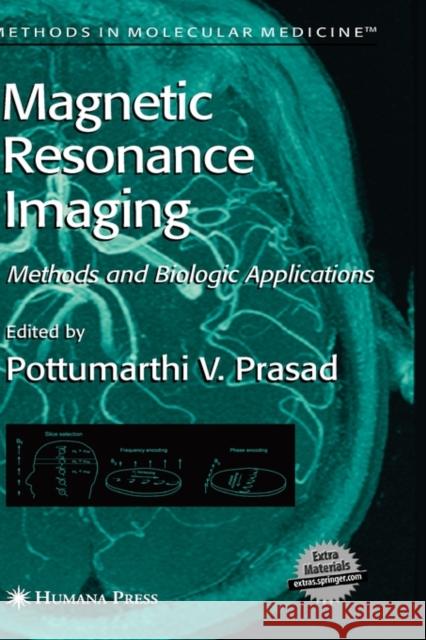 Magnetic Resonance Imaging: Methods and Biologic Applications Prasad, Pottumarthi V. 9781588293978 Humana Press - książka