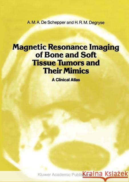 Magnetic Resonance Imaging of Bone and Soft Tissue Tumors and Their Mimics: A Clinical Atlas Schepper, A. M. a. De 9789401069380 Springer - książka