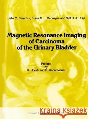 Magnetic Resonance Imaging of Carcinoma of the Urinary Bladder Jelle O. Barentsz Frans M. J. Debruyne J. H. J. Ruijs 9789401067782 Springer - książka