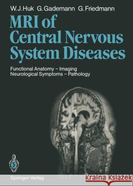 Magnetic Resonance Imaging of Central Nervous System Diseases: Functional Anatomy -- Imaging Neurological Symptoms -- Pathology Huk, Werner J. 9783642725708 Springer - książka