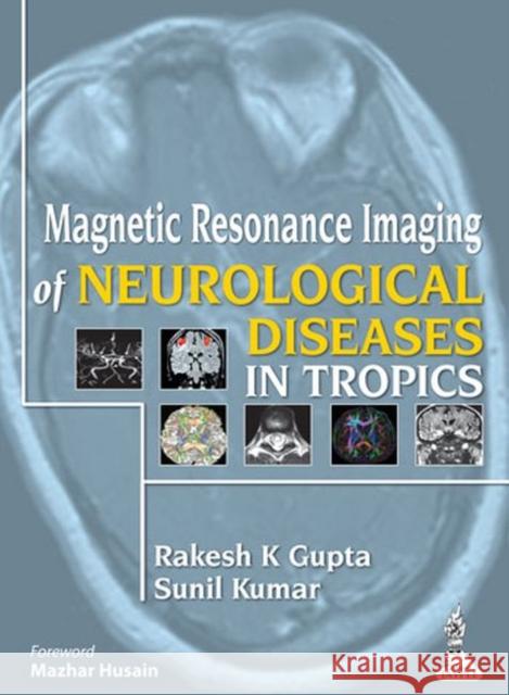 Magnetic Resonance Imaging of Neurological Diseases in Tropics Rakesh K. Gupta 9789350909720 Jp Medical Ltd - książka