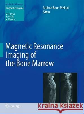 Magnetic Resonance Imaging of the Bone Marrow Andrea Baur-Melnyk 9783642178597 Springer - książka