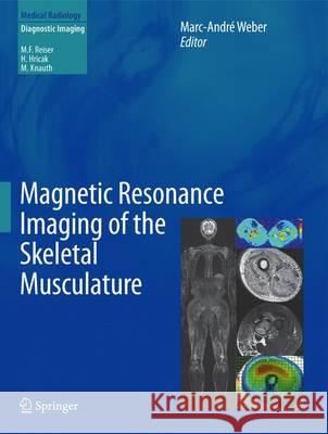 Magnetic Resonance Imaging of the Skeletal Musculature Marc-Andre Weber 9783642372186 Springer - książka