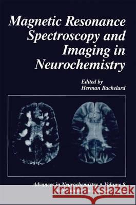 Magnetic Resonance Spectroscopy and Imaging in Neurochemistry Herman Bachelard 9780306455209 Kluwer Academic Publishers - książka