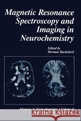 Magnetic Resonance Spectroscopy and Imaging in Neurochemistry Herman Bachelard 9781461376880 Springer - książka