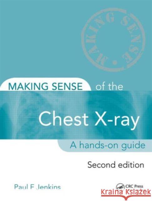 Making Sense of the Chest X-Ray: A Hands-On Guide Jenkins, Paul 9781444135152  - książka