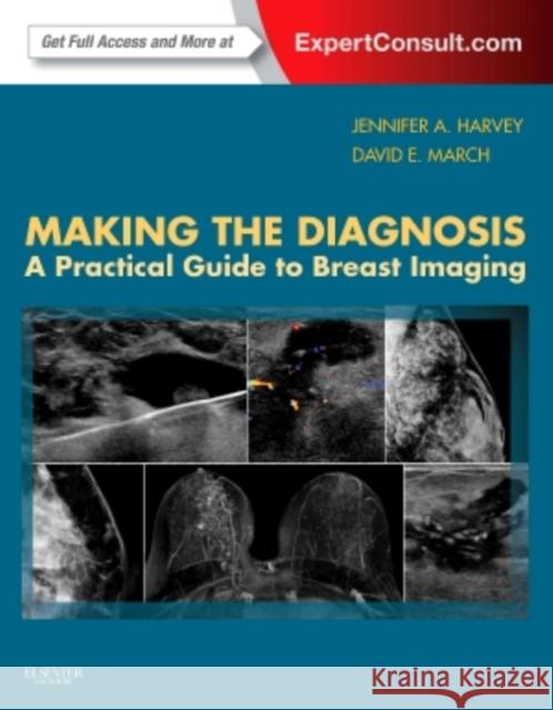 Making the Diagnosis: A Practical Guide to Breast Imaging: Expert Consult - Online and Print Harvey, Jennifer 9781455722846 W.B. Saunders Company - książka