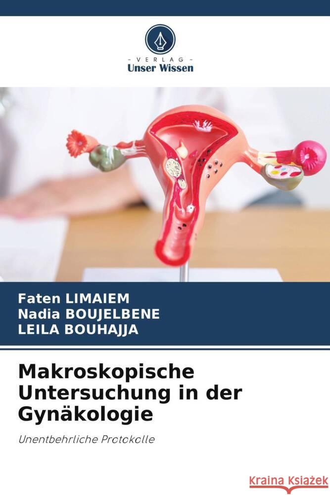 Makroskopische Untersuchung in der Gynäkologie Limaiem, Faten, BOUJELBENE, Nadia, BOUHAJJA, Leila 9786203694918 Verlag Unser Wissen - książka