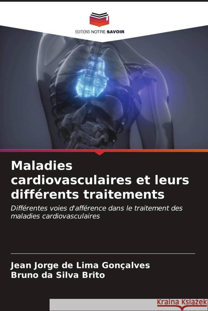 Maladies cardiovasculaires et leurs différents traitements Gonçalves, Jean Jorge de Lima, Brito, Bruno da Silva 9786206531111 Editions Notre Savoir - książka