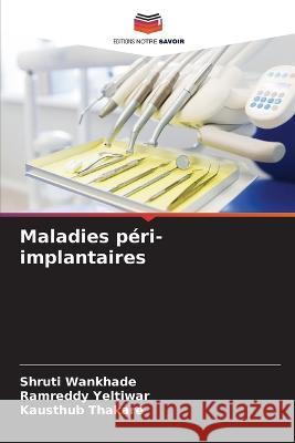 Maladies peri-implantaires Shruti Wankhade Ramreddy Yeltiwar Kausthub Thakare 9786205797914 Editions Notre Savoir - książka