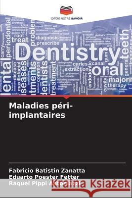 Maladies péri-implantaires Batistin Zanatta, Fabricio, Poester Fetter, Eduarto, Pippi Antoniazzi, Raquel 9786208693855 Editions Notre Savoir - książka