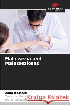 Malassezia and Malassezioses Adila Bassaid Yassine Merad Mohand Ouali Ai 9786205729762 Our Knowledge Publishing - książka