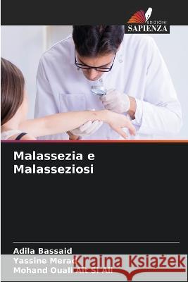 Malassezia e Malasseziosi Adila Bassaid Yassine Merad Mohand Ouali Ai 9786205729892 Edizioni Sapienza - książka