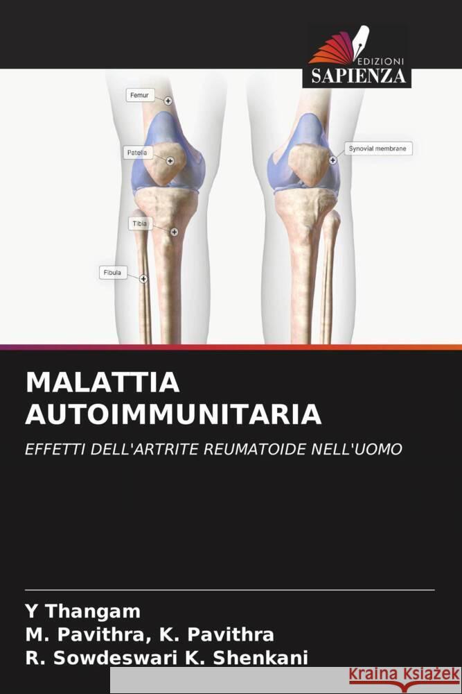 Malattia Autoimmunitaria Y Thangam M Pavithra K Pavithra R Sowdeswari K Shenkani 9786205896341 Edizioni Sapienza - książka