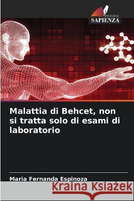 Malattia di Behcet, non si tratta solo di esami di laboratorio Maria Fernanda Espinoza   9786206260981 Edizioni Sapienza - książka