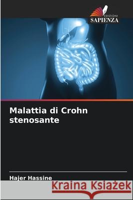 Malattia di Crohn stenosante Hassine, Hajer 9786209478666 Edizioni Sapienza - książka