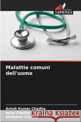 Malattie comuni dell'uomo Ashok Kumar Chadha Asha Chadha Abhishek Chadha 9786209122989 Edizioni Sapienza - książka