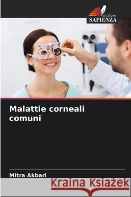Malattie corneali comuni Akbari, Mitra 9786209051746 Edizioni Sapienza - książka