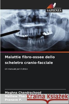 Malattie fibro-ossee dello scheletro cranio-facciale Chandrachood, Meghna, Tharakan, Mathew, P., Pranave 9786209120756 Edizioni Sapienza - książka