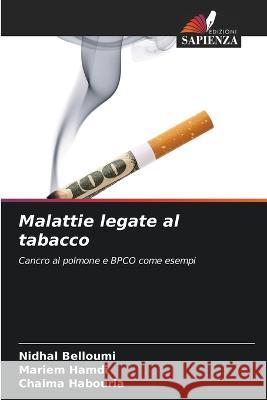 Malattie legate al tabacco Nidhal Belloumi Mariem Hamdi Chaima Habouria 9786205264409 Edizioni Sapienza - książka