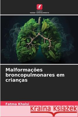 Malforma??es broncopulmonares em crian?as Fatma Khalsi 9786207688043 Edicoes Nosso Conhecimento - książka