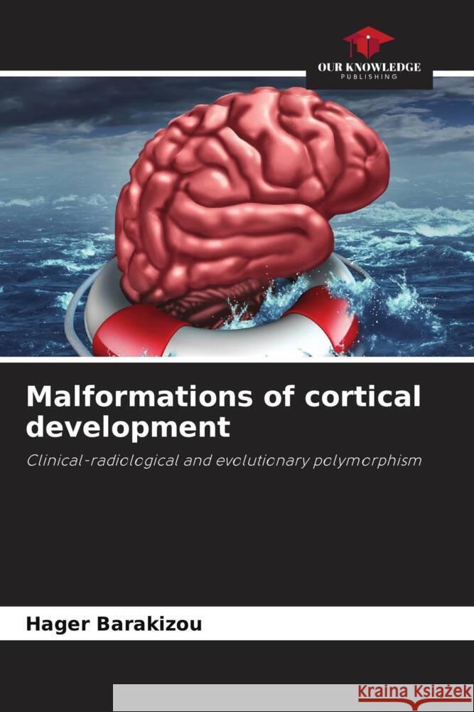 Malformations of cortical development Barakizou, Hager 9786204665979 Our Knowledge Publishing - książka