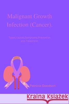 Malignant Growth Infection (Cancer).: Types, Causes, Symptoms, Prevention and Treatment. Patricia Goodson 9798357046710 Independently Published - książka