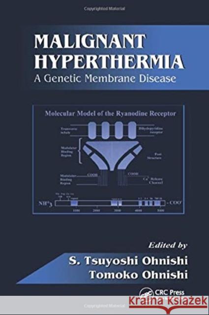 Malignant Hyperthermia: A Genetic Membrane Disease S. Tsuyoshi Ohnishi Tomoko Ohnishi 9780367449629 CRC Press - książka