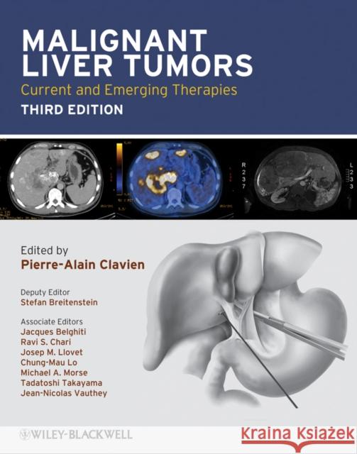 Malignant Liver Tumors: Current and Emerging Therapies Clavien, Pierre-Alain 9781405179768 Wiley-Blackwell - książka