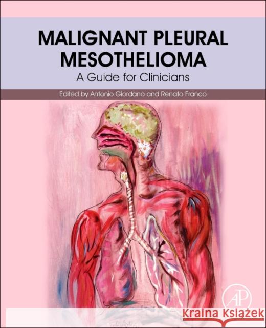 Malignant Pleural Mesothelioma: A Guide for Clinicians Antonio Giordano Renato Franco 9780128127247 Academic Press - książka