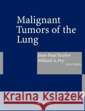 Malignant Tumors of the Lung: Evidence-Based Management Sculier, J. P. 9783540438878 Springer - książka